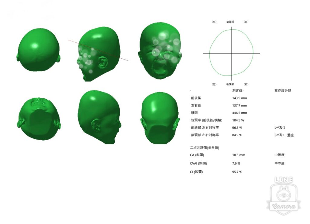 泣きながら3D撮影したので写真も泣いてますw